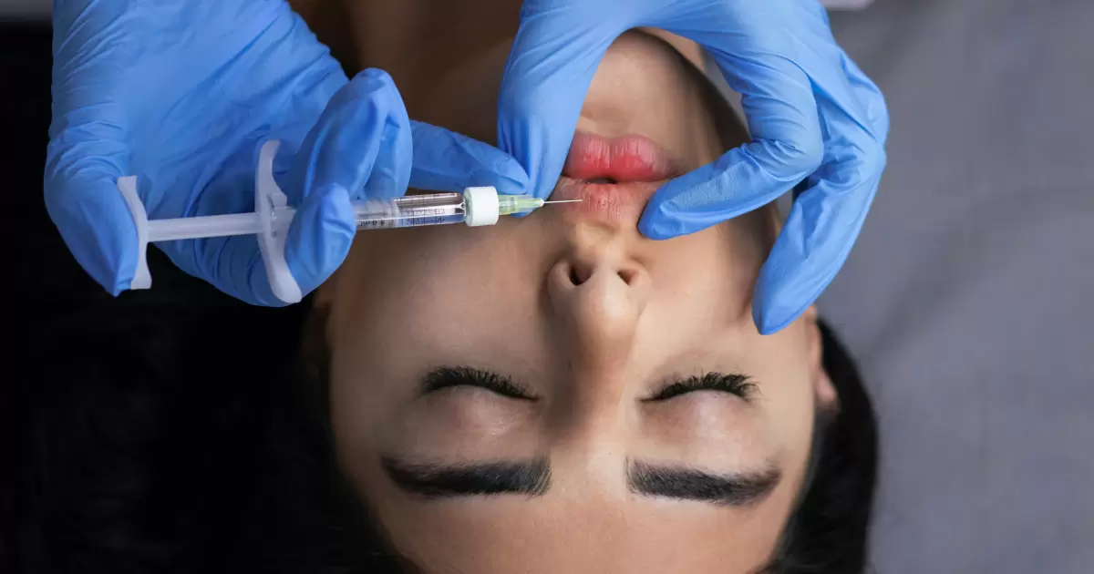 Percantik Diri dengan Filler, Botox, dan Tanam Benang Diperbolehkan Asal…